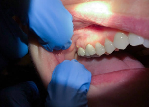 Best Pediatric Emergency Dentist in Suncrest, WA
